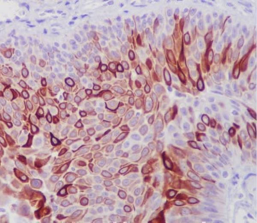 Anti-Cytokeratin 10 KRT10 Rabbit Monoclonal Antibody Boster Bio