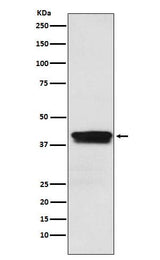 Anti-MBNL1 Rabbit Monoclonal Antibody Boster Bio