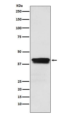 Anti-MBNL1 Rabbit Monoclonal Antibody Boster Bio