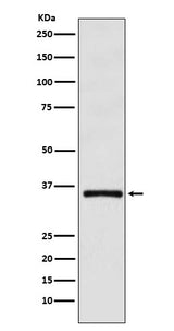 Anti-DMRT1 Monoclonal Antibody Boster Bio