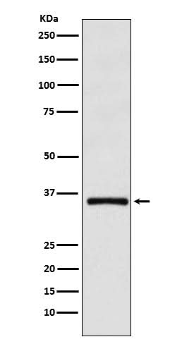 Anti-DMRT1 Monoclonal Antibody Boster Bio