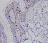 Anti-Langerin (CD207) Rabbit Monoclonal Antibody Boster Bio