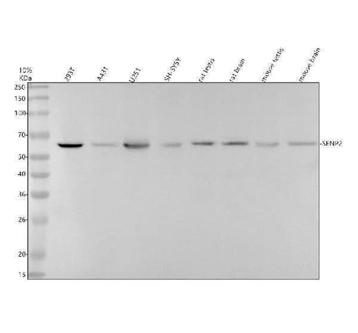 Anti-SENP2 Rabbit Monoclonal Antibody Boster Bio