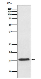 Anti-VAMP2 Rabbit Monoclonal Antibody Boster Bio