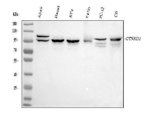 Anti-delta 1 Catenin/CAS/CTNND1 Antibody Picoband® (monoclonal, 8G7E4 Boster Bio