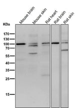 Anti-delta 1 Catenin/p120 Catenin Rabbit Monoclonal Antibody Boster Bio