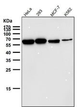 Anti-P4HB Rabbit Monoclonal Antibody Boster Bio