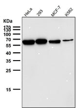 Anti-P4HB Rabbit Monoclonal Antibody Boster Bio