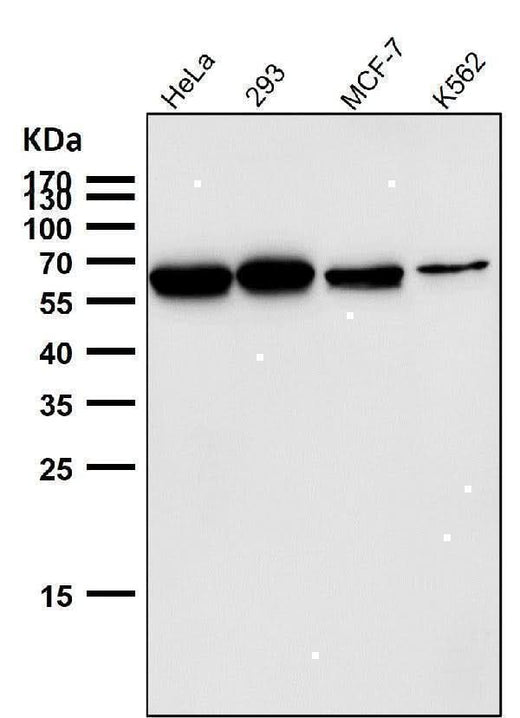 Anti-P4HB Rabbit Monoclonal Antibody Boster Bio