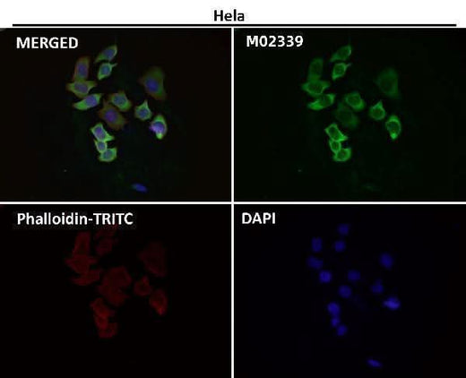 Anti-eIF3A Rabbit Monoclonal Antibody Boster Bio