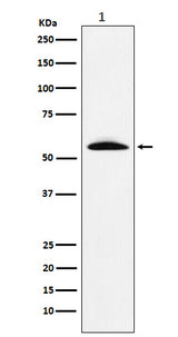 Anti-GGT1 Rabbit Monoclonal Antibody Boster Bio