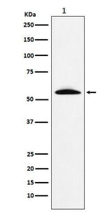 Anti-GGT1 Rabbit Monoclonal Antibody Boster Bio