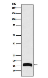 Anti-FLAP Rabbit Monoclonal Antibody Boster Bio