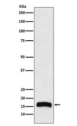 Anti-FLAP Rabbit Monoclonal Antibody Boster Bio