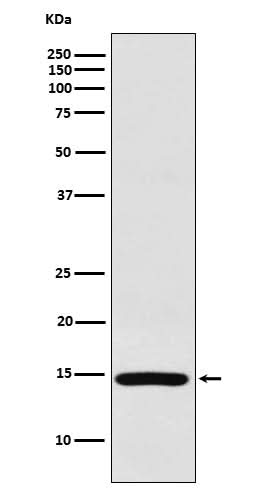 Anti-RPS19 Rabbit Monoclonal Antibody Boster Bio