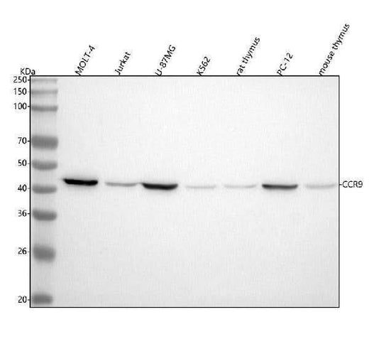 Anti-CCR9 Rabbit Monoclonal Antibody Boster Bio