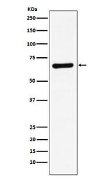 Anti-STXBP1 Rabbit Monoclonal Antibody Boster Bio