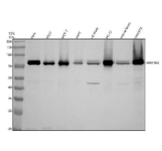 Anti-MEKK2 MAP3K2 Rabbit Monoclonal Antibody Boster Bio