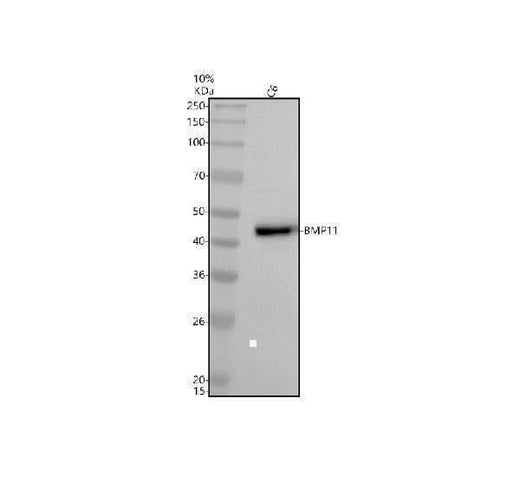 Anti-BMP11 GDF11 Rabbit Monoclonal Antibody Boster Bio