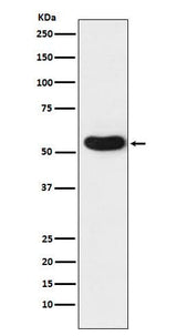 Anti-CHRNA5 Rabbit Monoclonal Antibody Boster Bio