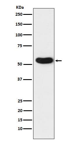 Anti-CHRNA5 Rabbit Monoclonal Antibody Boster Bio