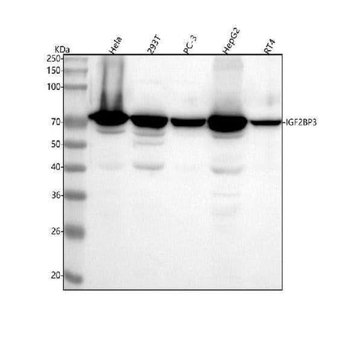 Anti-IMP3 IGF2BP3 Monoclonal Antibody Boster Bio