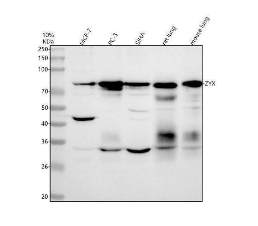 Anti-Zyxin Monoclonal Antibody Boster Bio