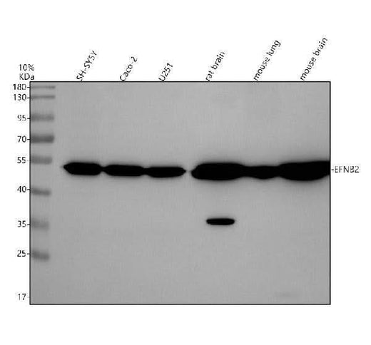 Anti-Ephrin B2 Rabbit Monoclonal Antibody Boster Bio