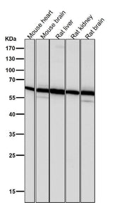Anti-PMP70 ABCD3 Monoclonal Antibody Boster Bio