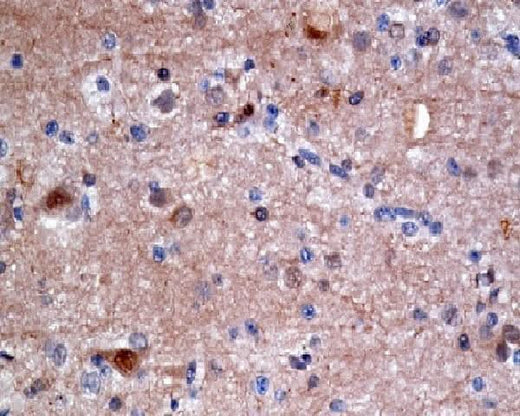 Anti-ATP citrate lyase ACLY Rabbit Monoclonal Antibody Boster Bio