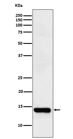 Anti-FABPI Rabbit Monoclonal Antibody Boster Bio