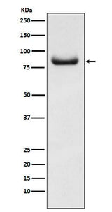 Anti-APPL Rabbit Monoclonal Antibody Boster Bio