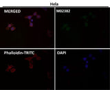 Anti-PFKFB3 Monoclonal Antibody Boster Bio