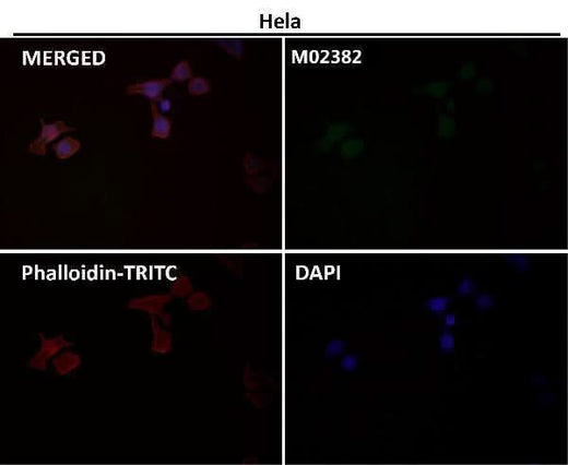 Anti-PFKFB3 Monoclonal Antibody Boster Bio