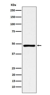 Anti-ACADM Rabbit Monoclonal Antibody Boster Bio