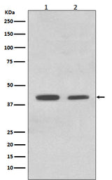 Anti-ACADM/Mcad Rabbit Monoclonal Antibody Boster Bio