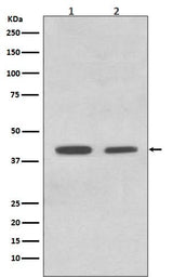 Anti-ACADM/Mcad Rabbit Monoclonal Antibody Boster Bio