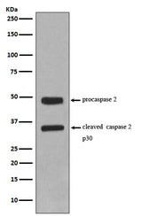 Anti-Caspase-2 CASP2 Rabbit Monoclonal Antibody Boster Bio