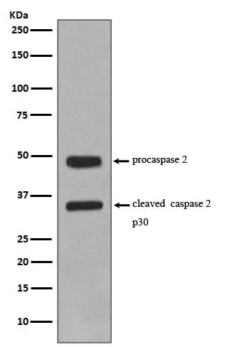 Anti-Caspase-2 CASP2 Rabbit Monoclonal Antibody Boster Bio