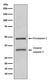 Anti-Caspase-2 CASP2 Rabbit Monoclonal Antibody Boster Bio