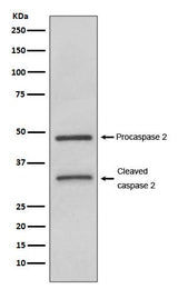Anti-Caspase-2 CASP2 Rabbit Monoclonal Antibody Boster Bio