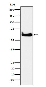 Anti-TCP1 alpha Rabbit Monoclonal Antibody Boster Bio