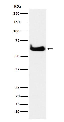 Anti-TCP1 alpha Rabbit Monoclonal Antibody Boster Bio