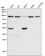 Anti-GRP94 HSP90B1 Rabbit Monoclonal Antibody Boster Bio