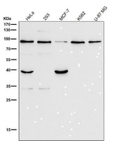 Anti-GRP94 HSP90B1 Rabbit Monoclonal Antibody Boster Bio