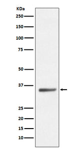 Anti-SIRT5/Sirtuin 5 Rabbit Monoclonal Antibody Boster Bio