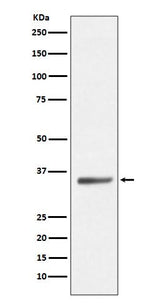 Anti-SIRT5/Sirtuin 5 Rabbit Monoclonal Antibody Boster Bio