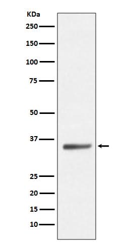 Anti-SIRT5/Sirtuin 5 Rabbit Monoclonal Antibody Boster Bio