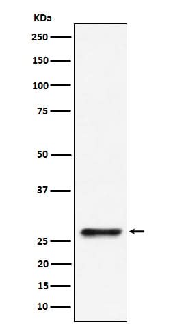 Anti-SBDS Rabbit Monoclonal Antibody Boster Bio