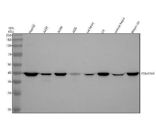 Anti-CKII alpha CSNK2A1 Rabbit Monoclonal Antibody Boster Bio